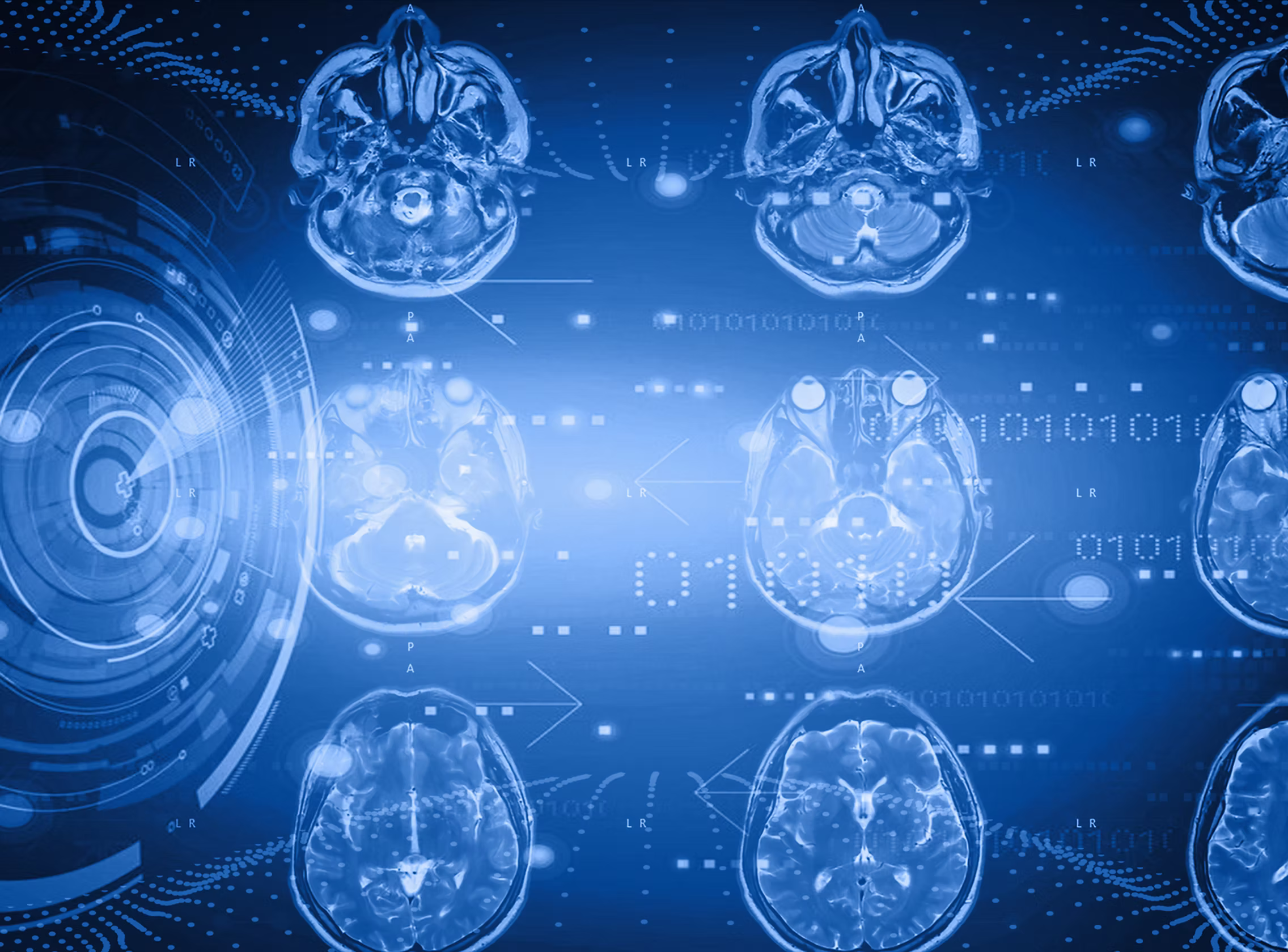Healthcare Diagnostic Insights MRI analysis.jpeg